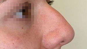 Prima