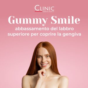 Gummy Smile