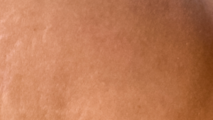 Dopo