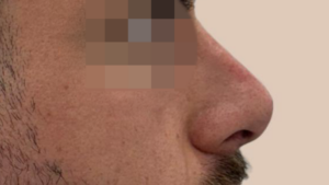 Dopo