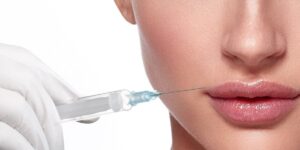 donna che si sottopone a filler labbra, costi